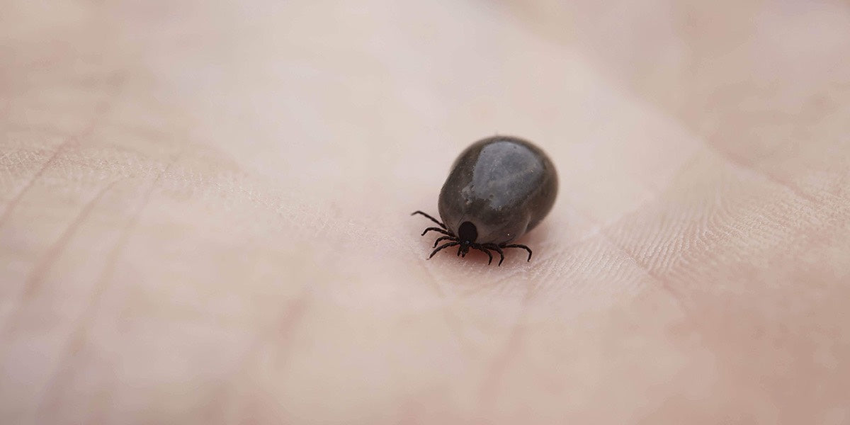 Entfernung von Zecken